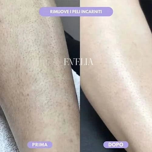 Epilatore a Nanocristalli: Dì addio ai peli senza dolore, senza irritazione e facilmente (2x1 🎁)
